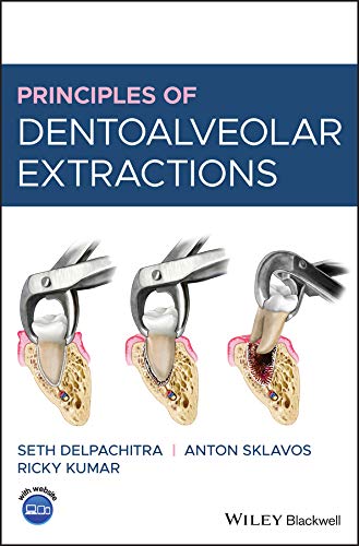 Principles of Dentoalveolar Extractions cover