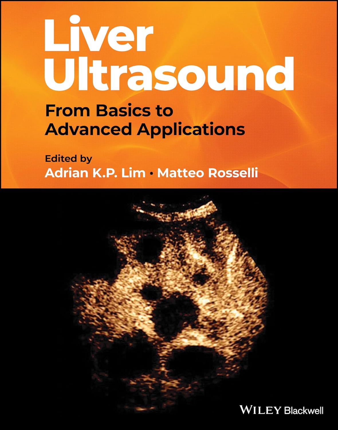 Liver Ultrasound: From Basics to Advanced Applications cover