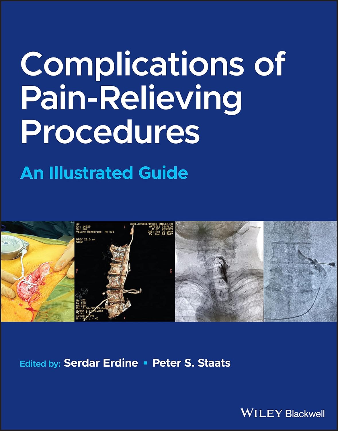 Complications of Pain-Relieving Procedures: An Illustrated Guide cover