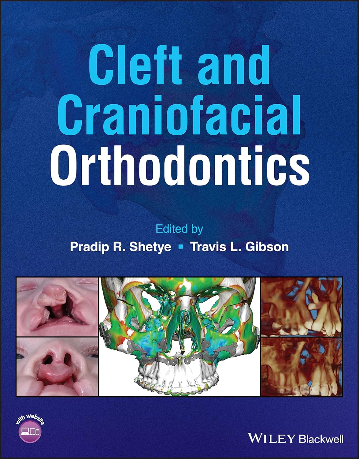 Cleft and Craniofacial Orthodontics cover