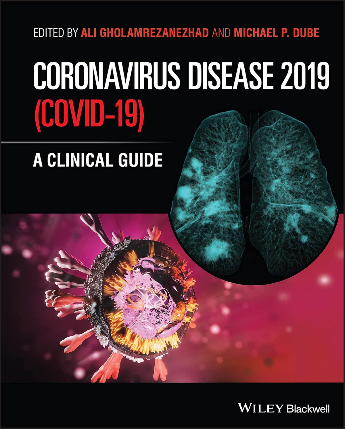 Coronavirus Disease 2019 (Covid-19): A Clinical Guide cover