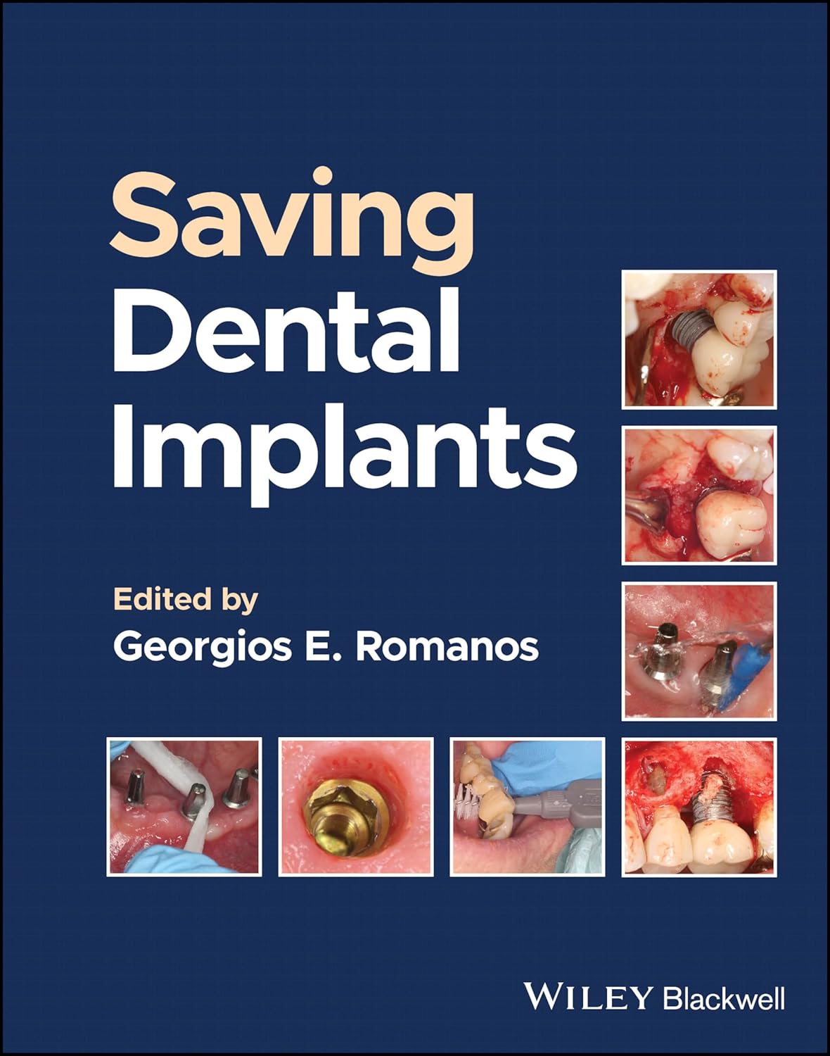 Saving Dental Implants cover