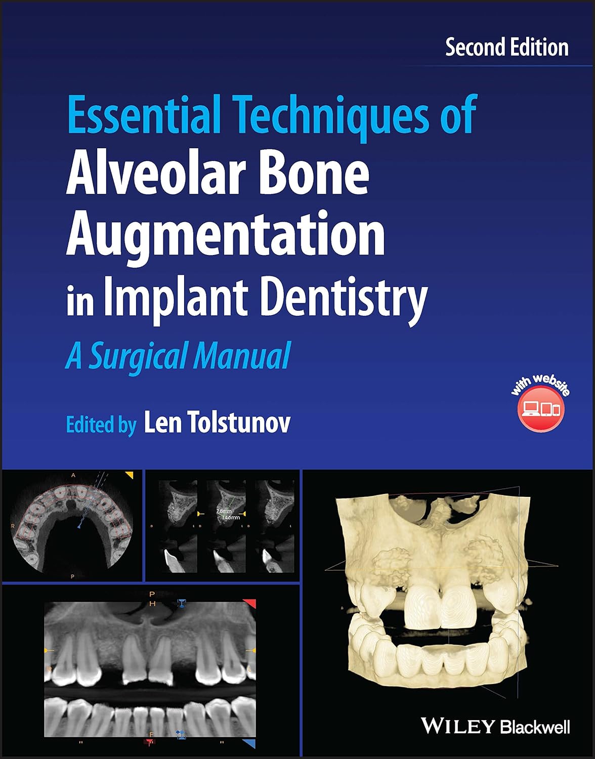 Essential Techniques of Alveolar Bone Augmentation in Implant Dentistry: A Surgical Manual cover