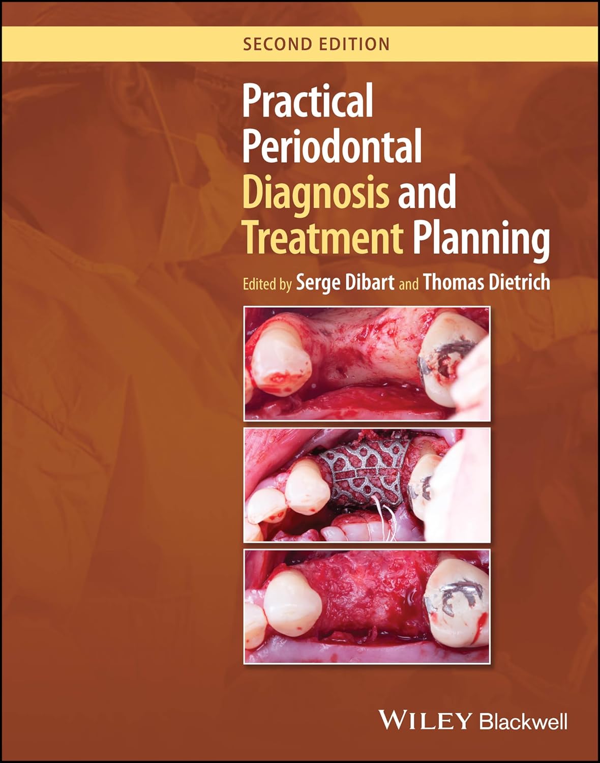 Practical Periodontal Diagnosis and Treatment Planning cover