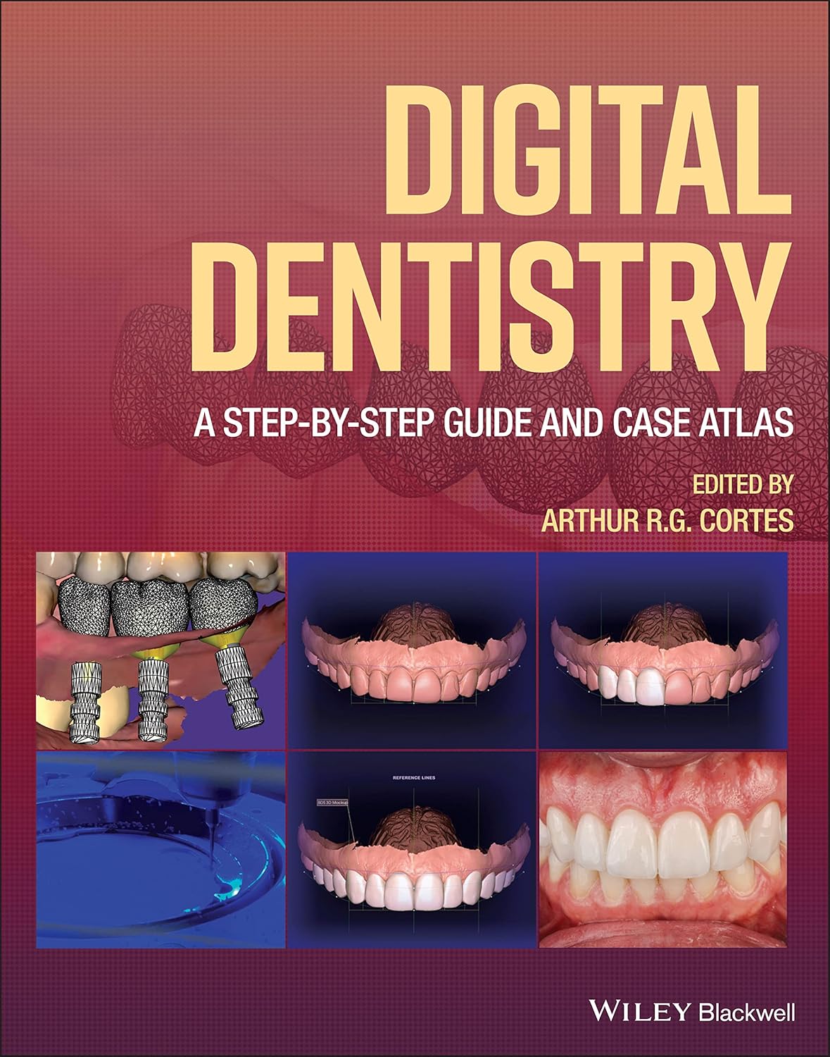 Digital Dentistry: A Step-by-Step Guide and Case Atlas cover