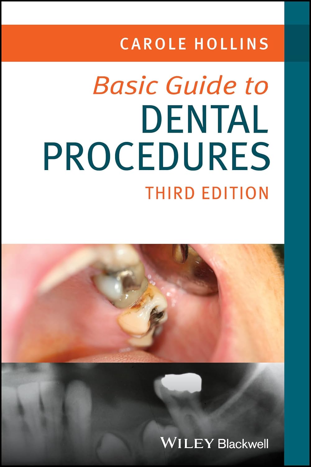 Basic Guide Dentistry Series cover