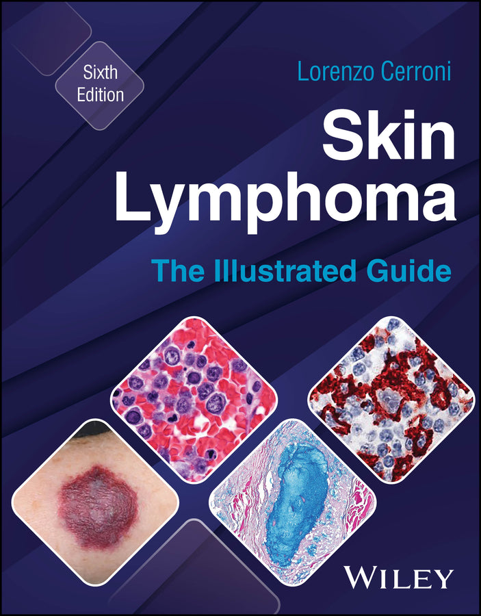 Skin Lymphoma: The Illustrated Guide cover