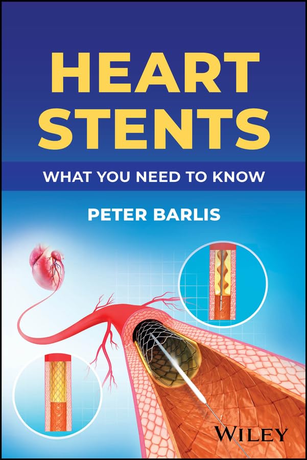 Heart Stents: What You Need to Know cover
