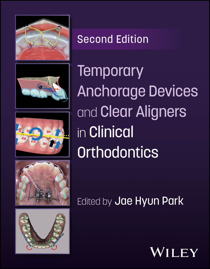 Temporary Anchorage Devices and Clear Aligners in Clinical Orthodontics cover