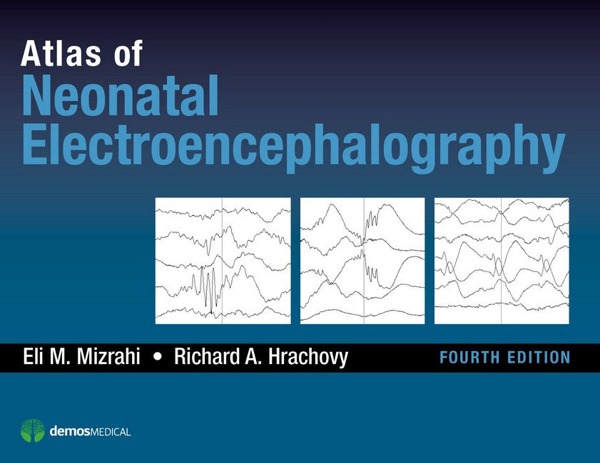 Atlas of Neonatal Electroencephalography cover
