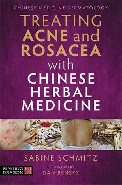 Treating Acne and Rosacea with Chinese Herbal Medicine cover