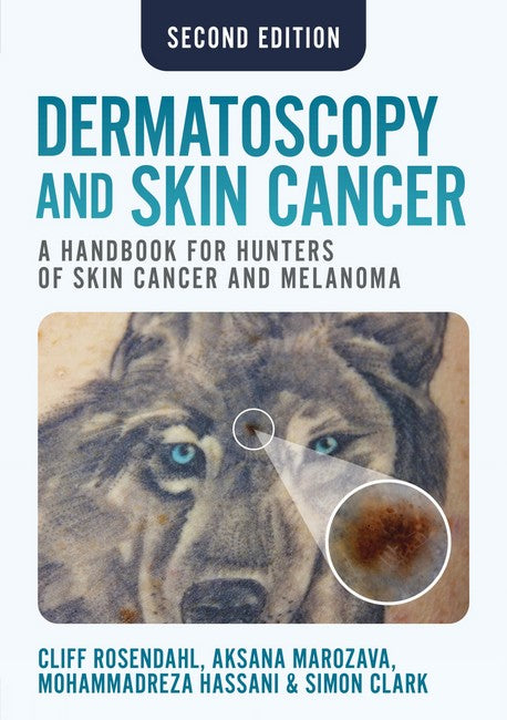 Dermatoscopy and Skin Cancer, second edition cover