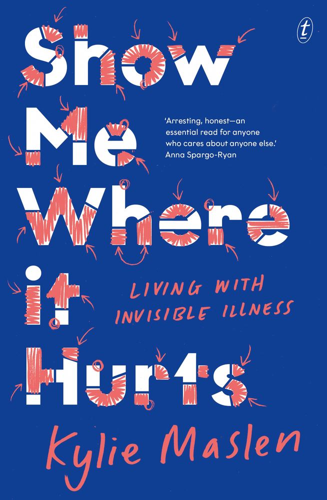 Show Me Where it Hurts book cover