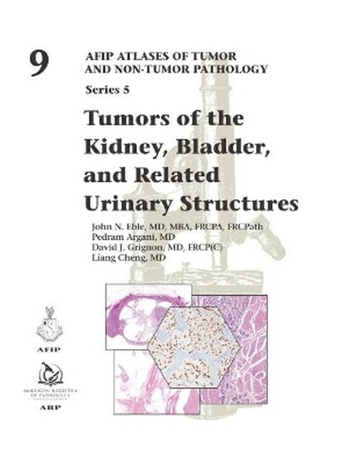 Tumors of the Kidney, Bladder, and Related Urinary Structures cover