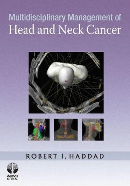 Multidisciplinary Management of Head and Neck Cancer cover